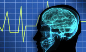 Measuring Community Resilience Equitably